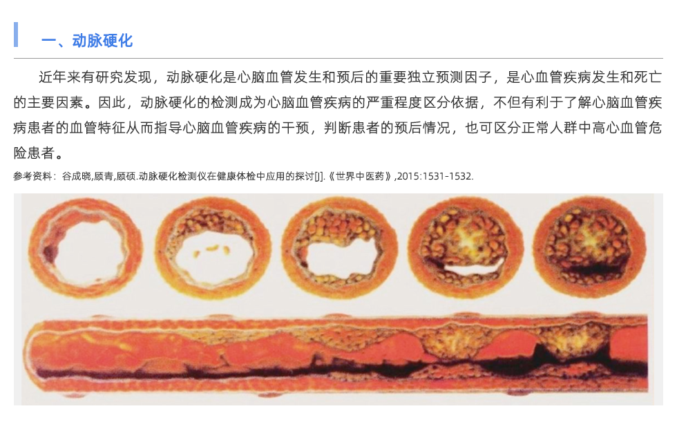 動(dòng)脈硬化檢測儀