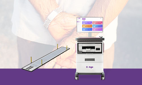 肌少癥與跌倒風(fēng)險(xiǎn)評(píng)估